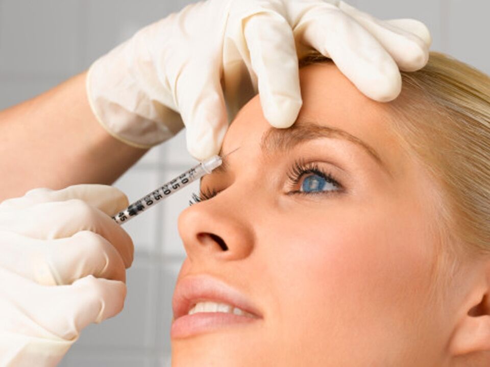 Filler rejuvenation