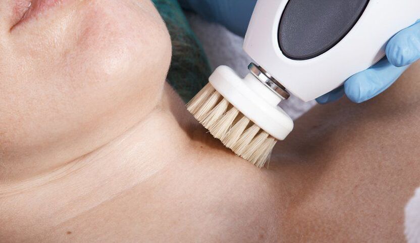 Bracing neck