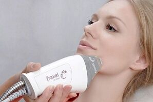 the essence of the fractional facial skin rejuvenation procedure