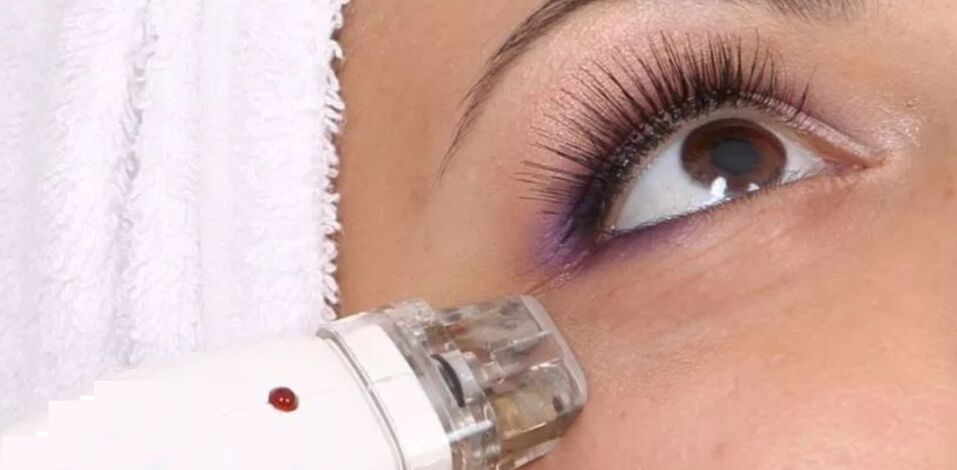 Rejuvenation technique using high temperature
