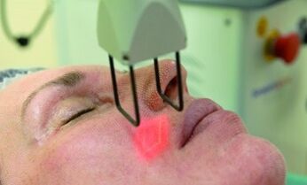 carrying out fractional laser rejuvenation procedures